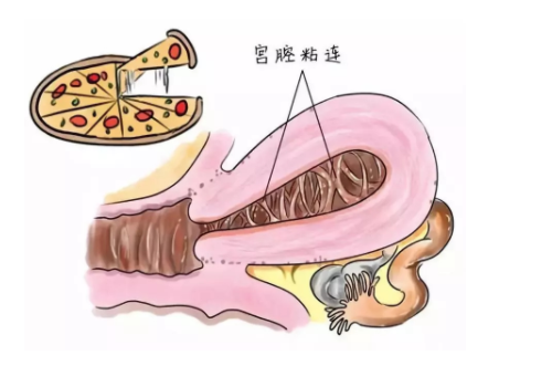 医院试管婴儿大概费用