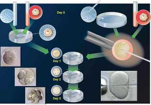 做俄罗斯第三代试管婴儿移植的胚胎是不是越多越好